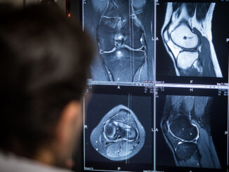 Manises realiza más de 750 intervenciones de prótesis de rodilla con un navegador de última generación.